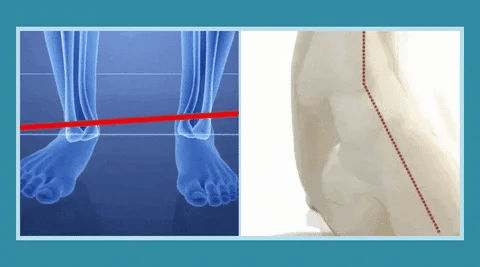 Carry Orthopaedic slip-on shoes!